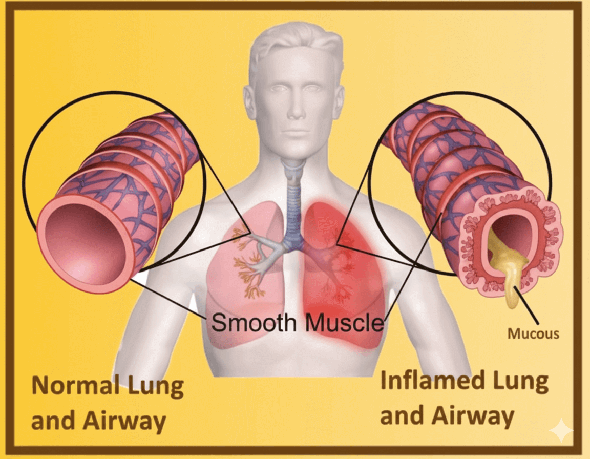 GlobalPrime Healthcare – Best Medical Equipment Supplier in Rajasthan | PneumoCare MuClear – Hands-Free Mucus Clearing Device GlobalPrime Healthcare – Best Medical Equipment Supplier in Rajasthan | PneumoCare MuClear – Hands-Free Mucus Clearing Device